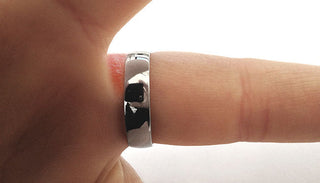 A close-up of a platinum wedding ring on a finger, highlighting a rash or irritation under the band.